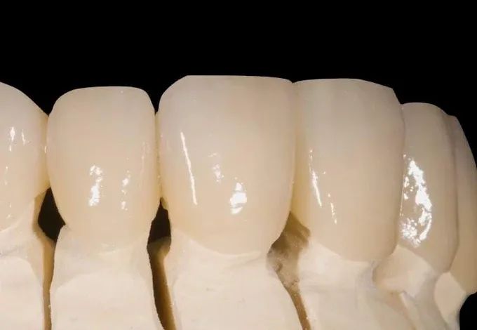 Elementi in ceramica su un modello